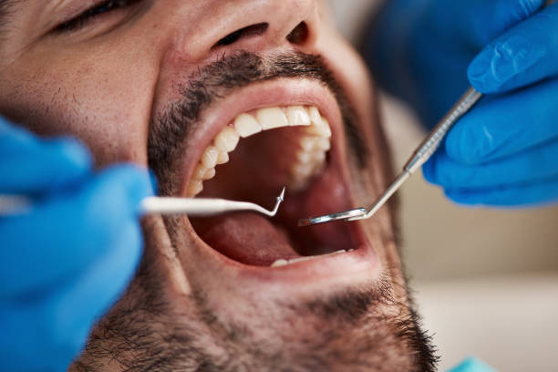 Best Emergency Dental Services for Seniors in Farmers Branch, TX