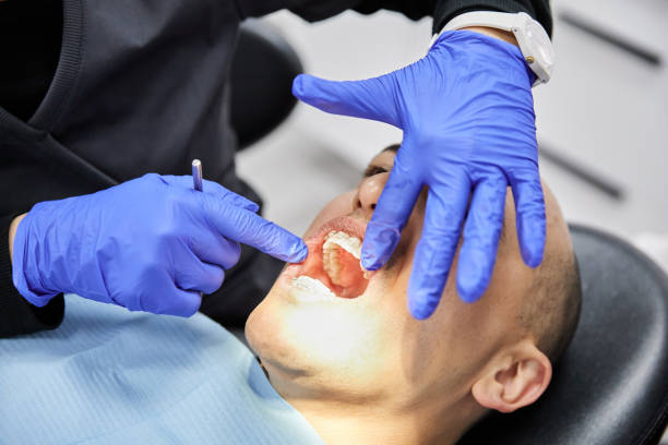 Best Emergency Dentist for Lost Fillings or Crowns in Farmers Branch, TX